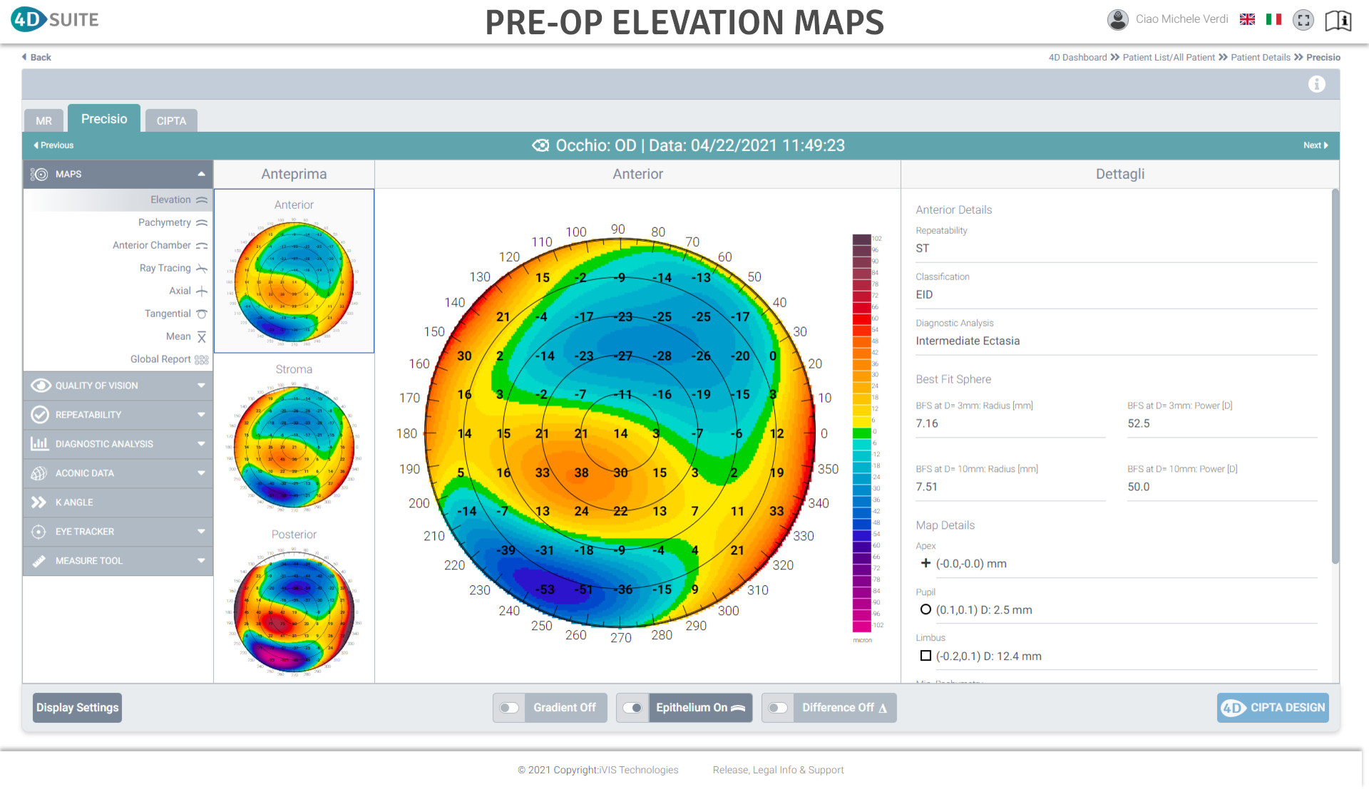 PREOP ELEVATION MAPS