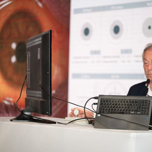 Video of the First intercontinental remotely controlled surgery @ World Keratoconus Congress