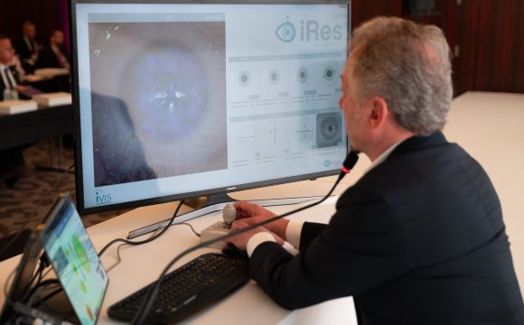 First intercontinental remotely controlled surgery at the 1st World Keratoconus Congress